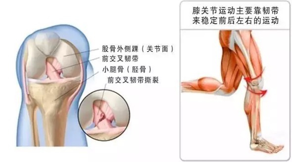 膝关节运动示意图。 本文图片 作者提供