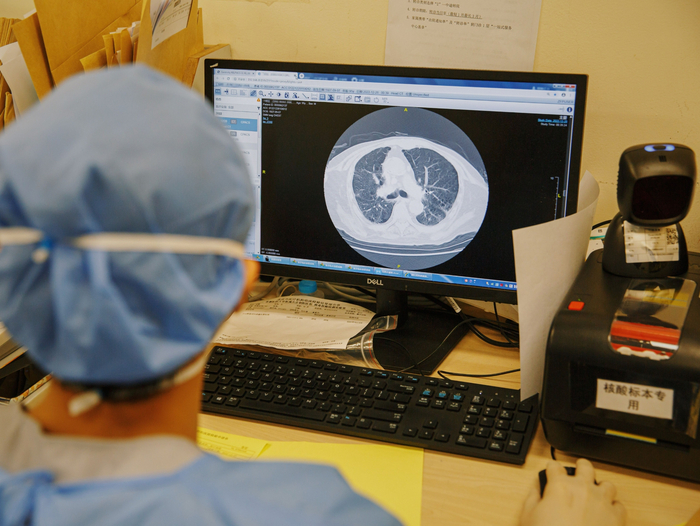 2022年12月28日凌晨，朝阳医院急诊科抢救室，医务人员查看的CT影像显示患者有“白肺”症状。新京报记者 郑新洽 摄