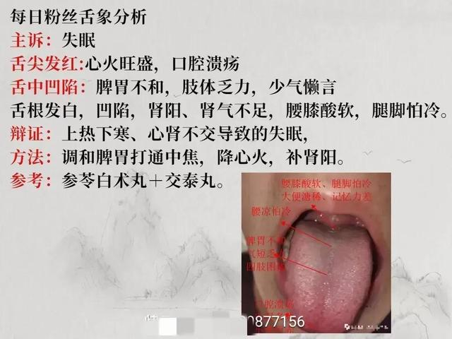 舌诊图,看着看着也学会了一点