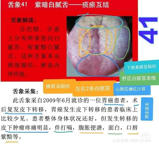 舌诊图,看着看着也学会了一点