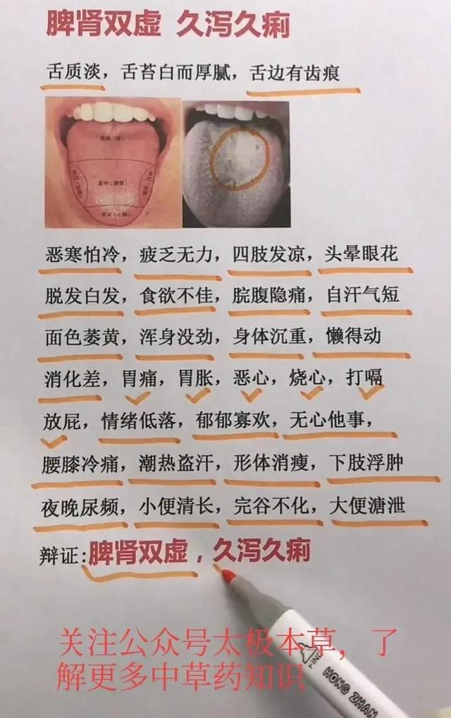 舌诊图，看着看着也学会了一点