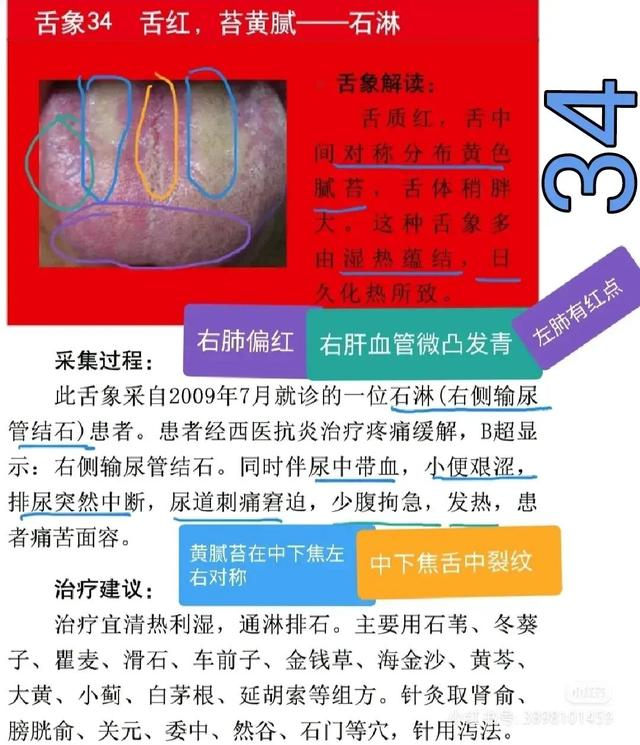舌诊图,看着看着也学会了一点