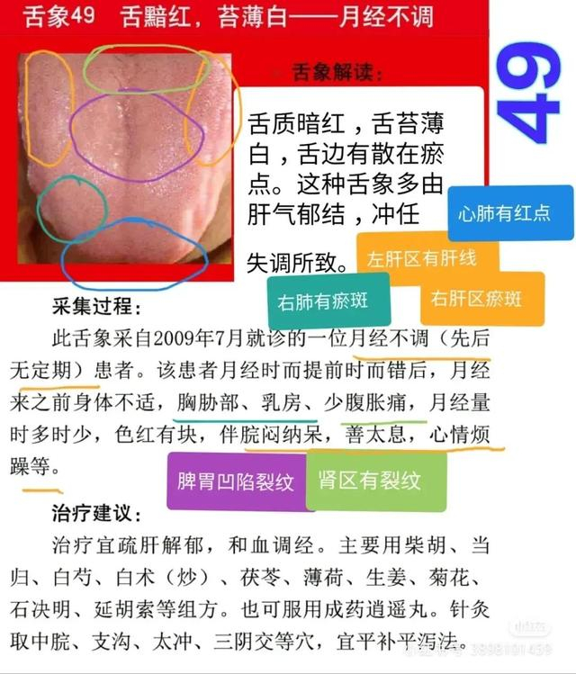舌诊图,看着看着也学会了一点
