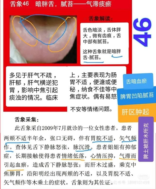 舌诊图,看着看着也学会了一点