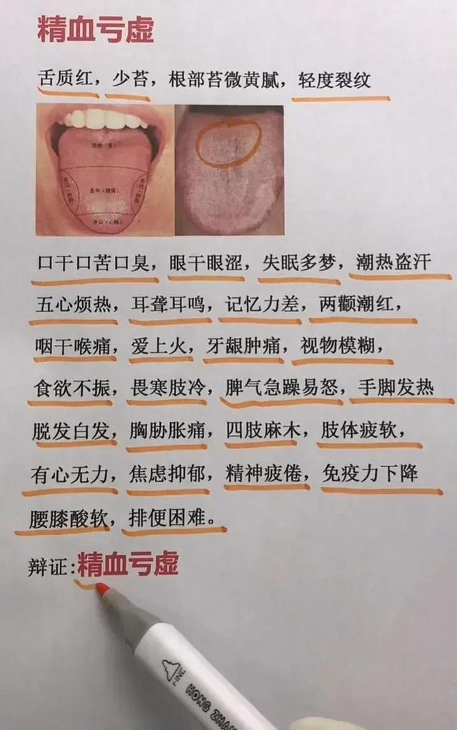 舌诊图,看着看着也学会了一点