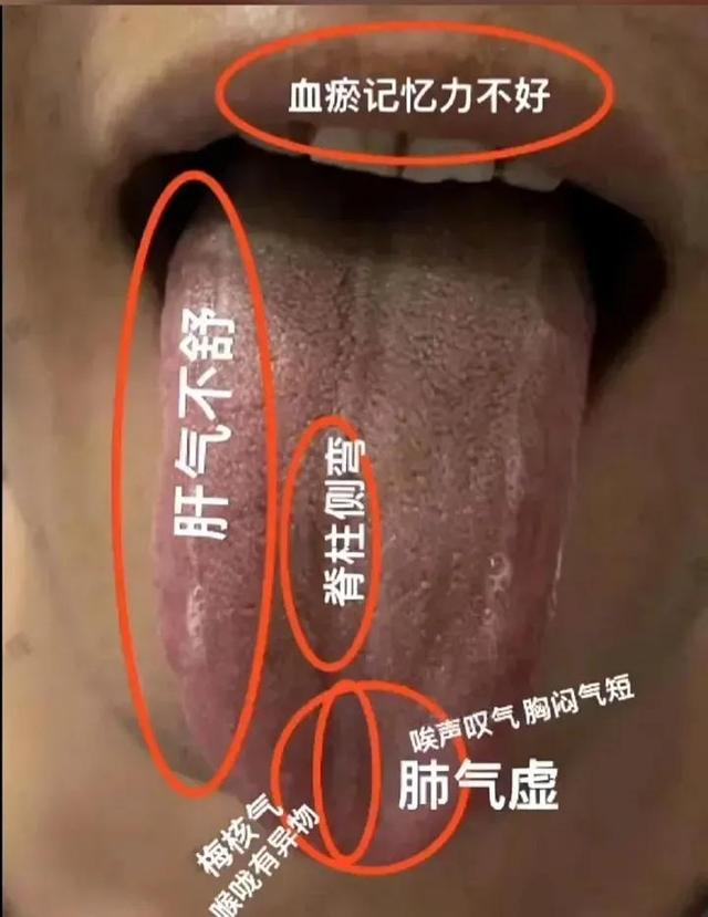 舌诊图,看着看着也学会了一点