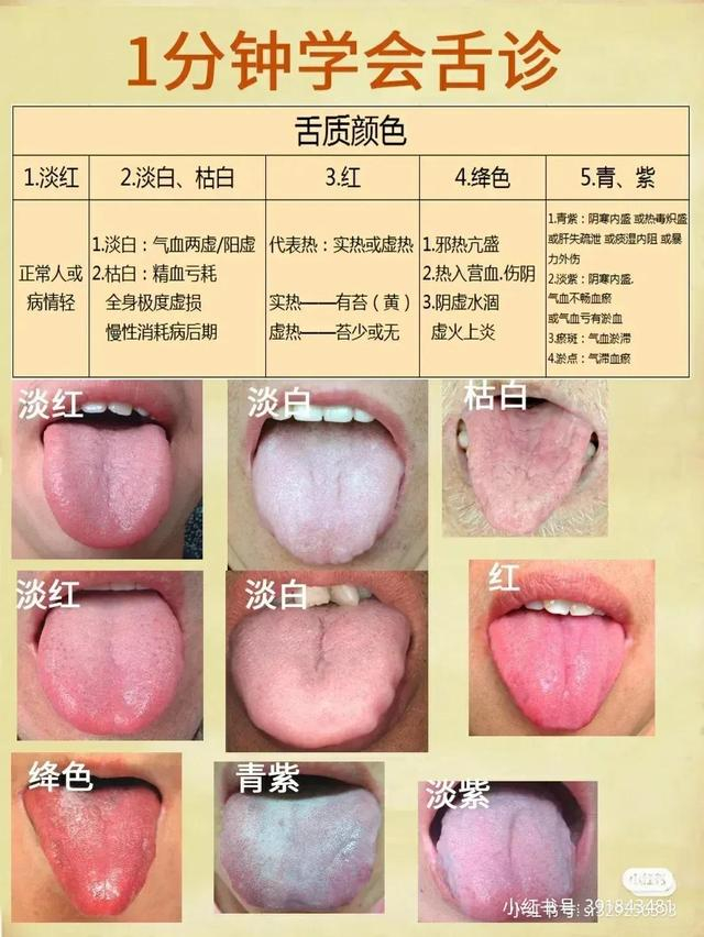 舌诊图,看着看着也学会了一点