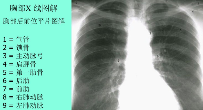 ICU常用导管位置,图文并茂,一文读懂