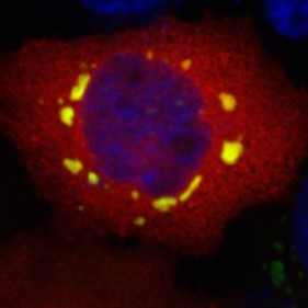 应激颗粒（黄色）像太阳系的行星一样环绕在细胞核（蓝色）周围。图片来源：浙江大学