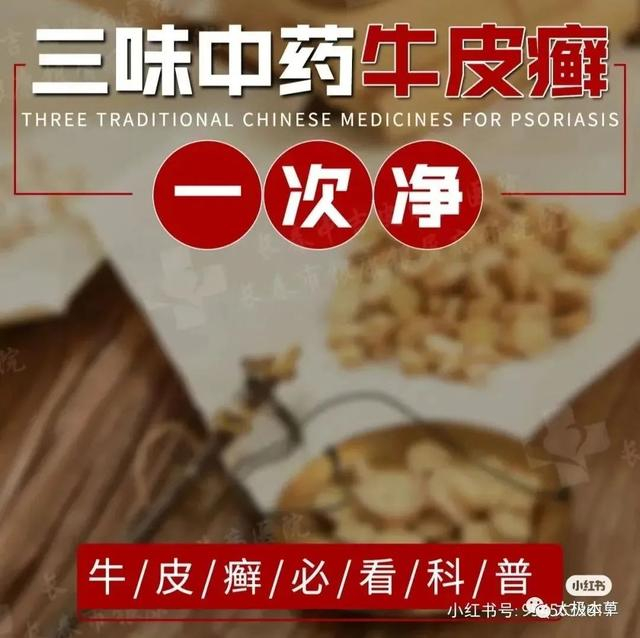 斑蝥,大毒,却是咱老百姓治疗牛皮癣,顽癣的特效yao