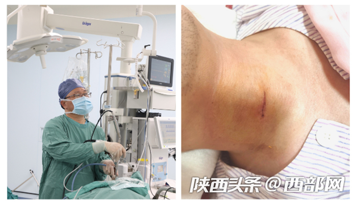 手术中的卫建民医生（左）缝合后的患者颈部伤口（右）