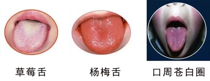 5种常见春季传染病,归笼的神兽需警惕