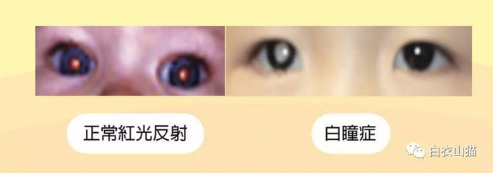 神奇!打开闪光灯给宝宝拍个照,竟然能够救宝宝一命!