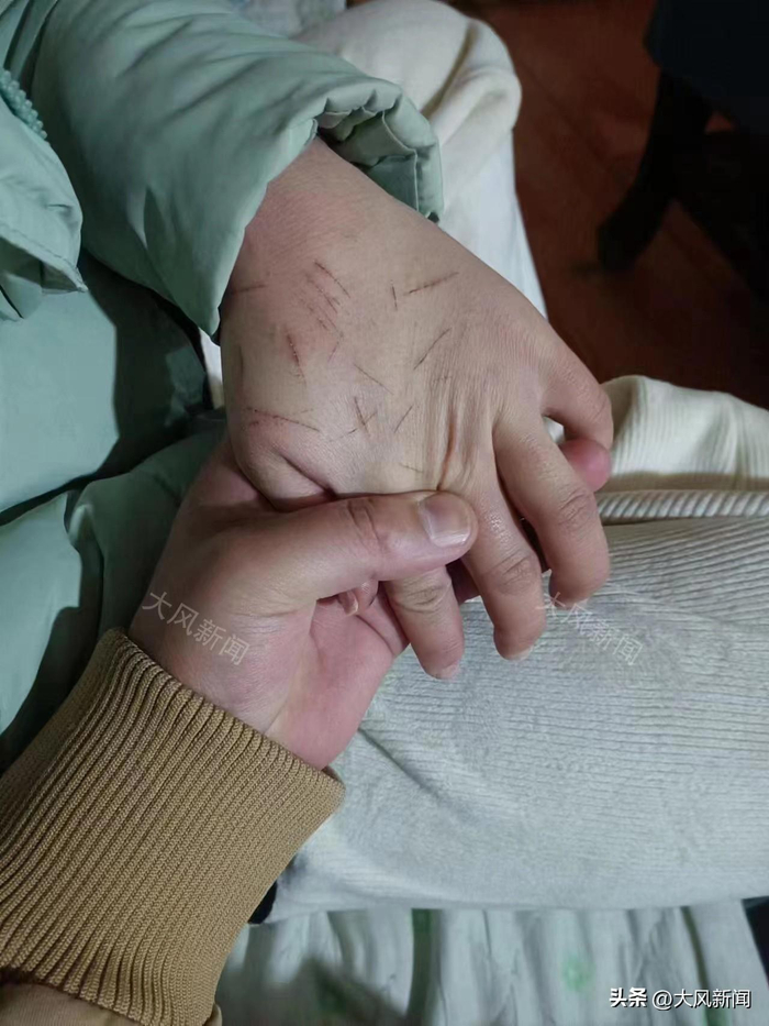 马先生说，案发一年多了，小燕仍未从阴影中走出，最近有2次自残行为