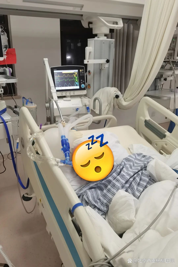 ▲患者行气管插管及机械通气治疗