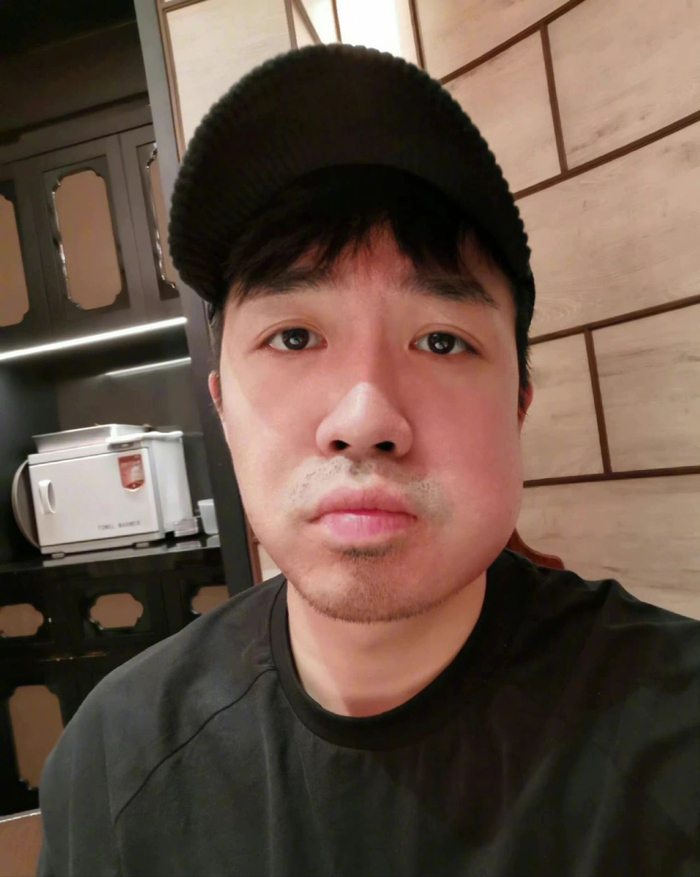 那些年曾去拔过智齿的明星们,吴宣仪做好肿脸的准备没