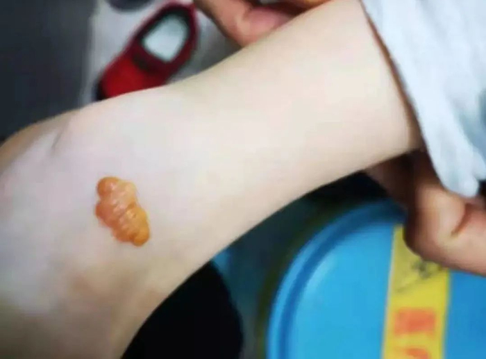 图片来源：厦门市第三医院