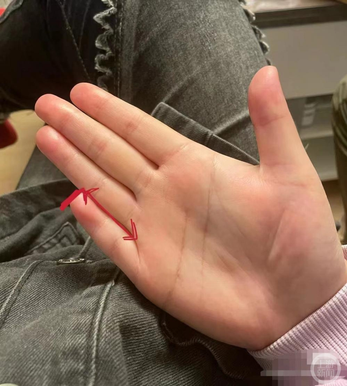 ▲网友发出的短指图片。 图片来源：网络