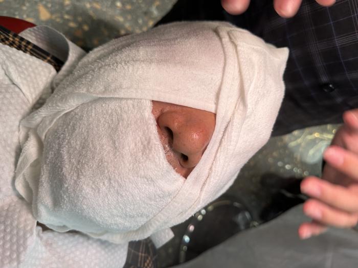 赵圣华体验洗脸美容项目