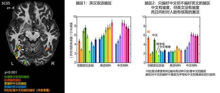 Sci Adv：詹旻野等报道中文字体可以激活的特定脑区