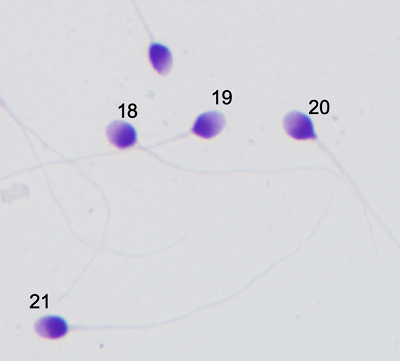 男科实验室中被定义为正常形态的精子。图源中华医学会