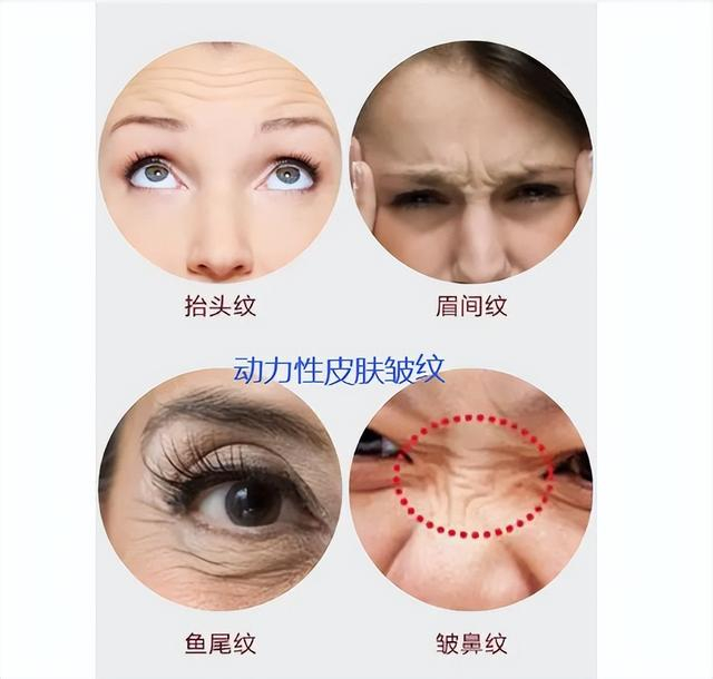 同样是打除皱针,母女2人为啥差别这么大