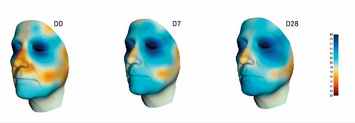 Emulium Dolcea MB具备显著保湿效果