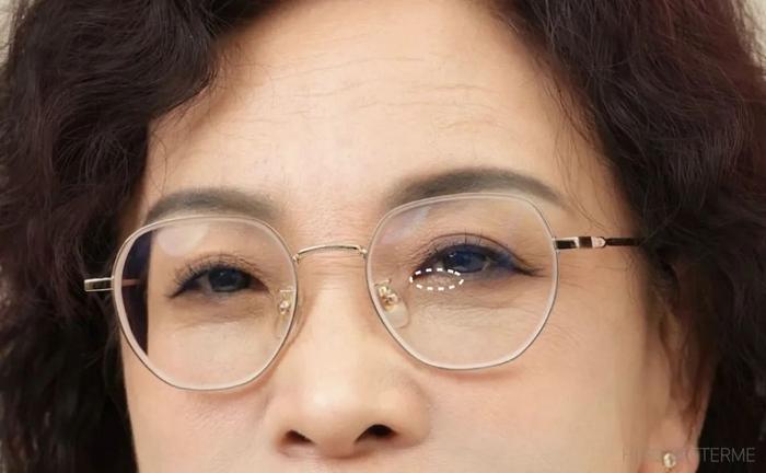 素人改造｜皮肤松弛、眼部下垂，如何将颜值最大化？(眼部下垂松弛怎么办)