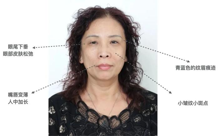 素人改造｜皮肤松弛、眼部下垂，如何将颜值最大化？(眼部下垂松弛怎么办)