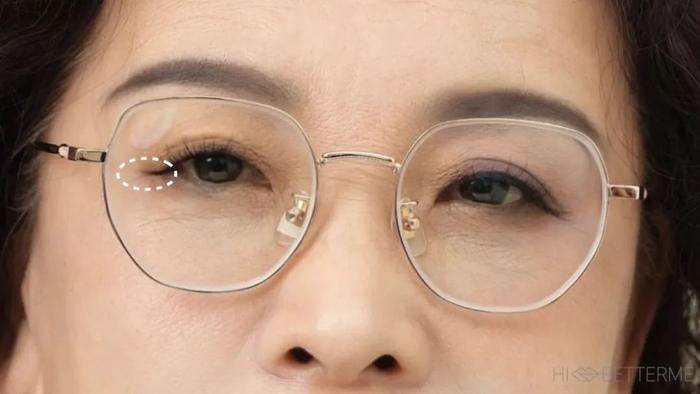 素人改造｜皮肤松弛、眼部下垂，如何将颜值最大化？(眼部下垂松弛怎么办)
