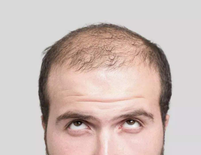 防脱育发产品哪款值得囤货 防脱洗发水育发液排名解析