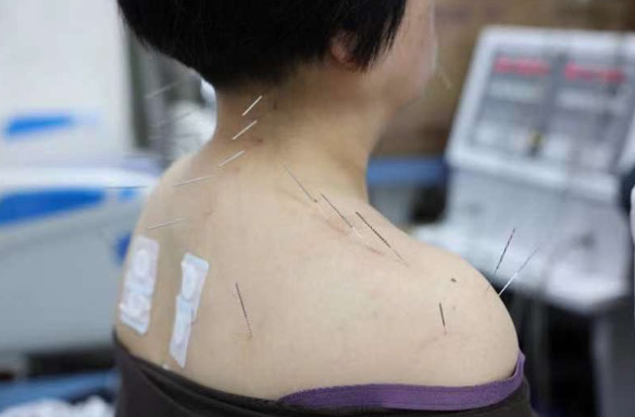 在贵州中医药大学第一附属医院产科病房，分娩后的产妇正在接受治疗