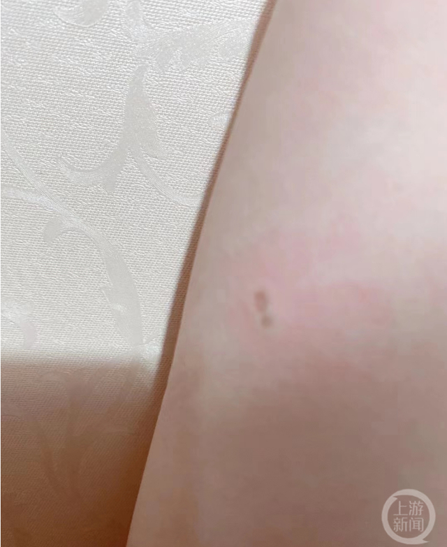 网民“醒”手臂被电后留下的印记。 图片来源/受访者供图