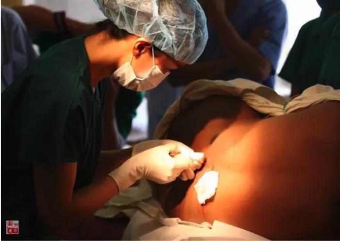 　　2010年11月12日，“和平方舟”号医院船麻醉师盛睿芳对沁的母亲实施麻醉，准备剖腹产。新华社记者琚振华摄