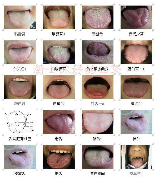 中医常见舌诊,比较全