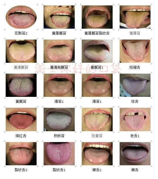 中医常见舌诊,比较全