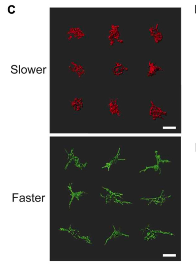 图丨10 微米尺度下具有代表性的间充质干细胞的细胞骨架 3D 效果图（3 小时）（来源：Science Advances）