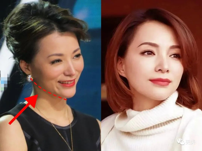 董卿与周涛相比,具有更强的精致感,最重要的原因就在于,她的下颌骨