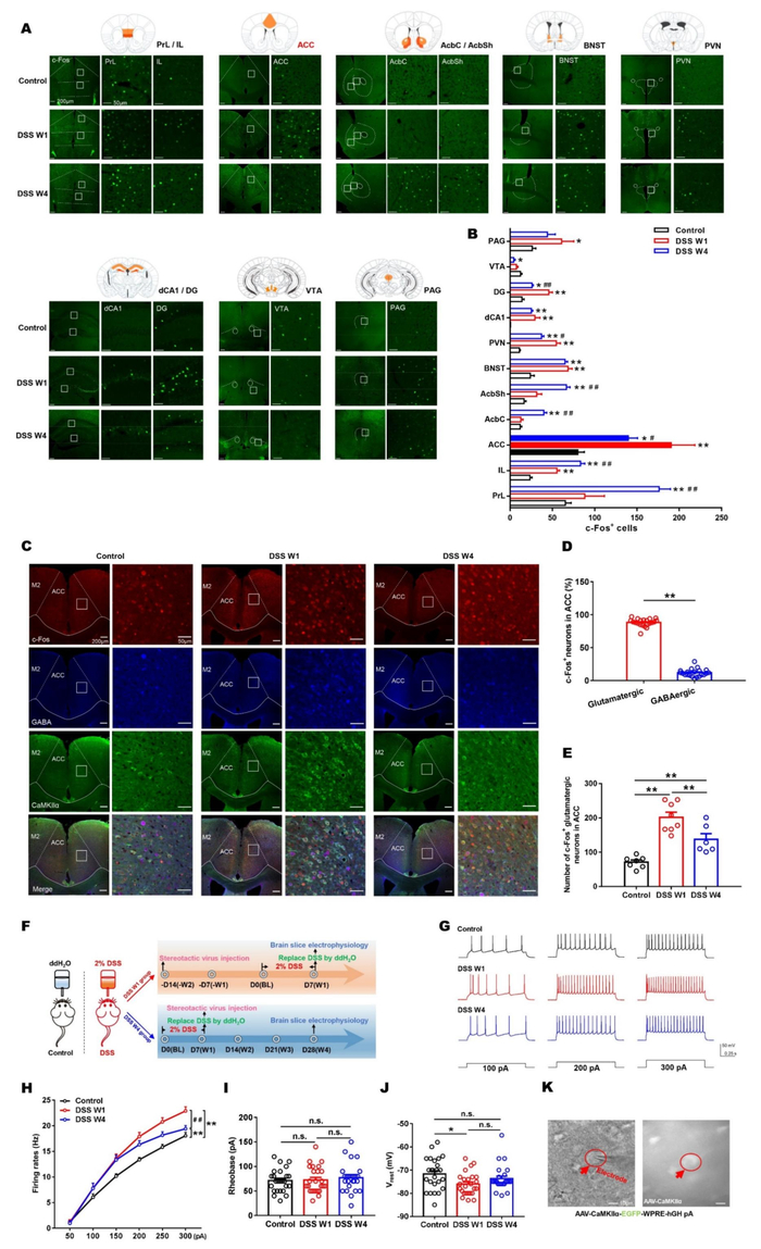 结肠炎的主要症状是什么？