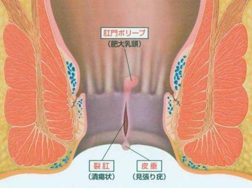 肛门是哪位置男女图片