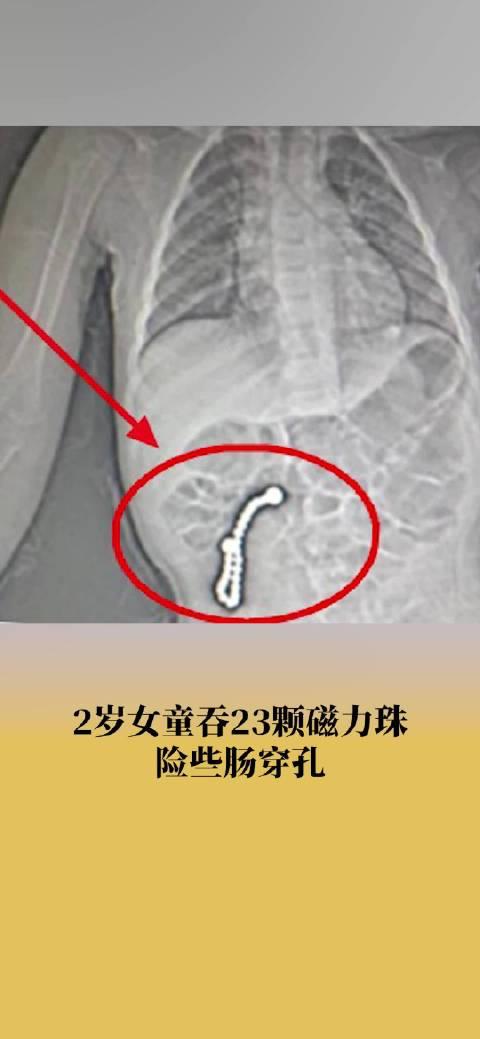 磁力珠对孩子有害吗=磁力珠对身体有影响么