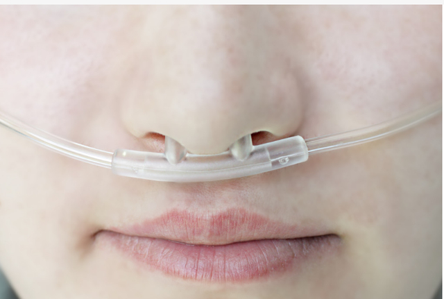 鼻导管吸氧的流量一般最高不超过5升/分,因为流量过高会使人产生不适