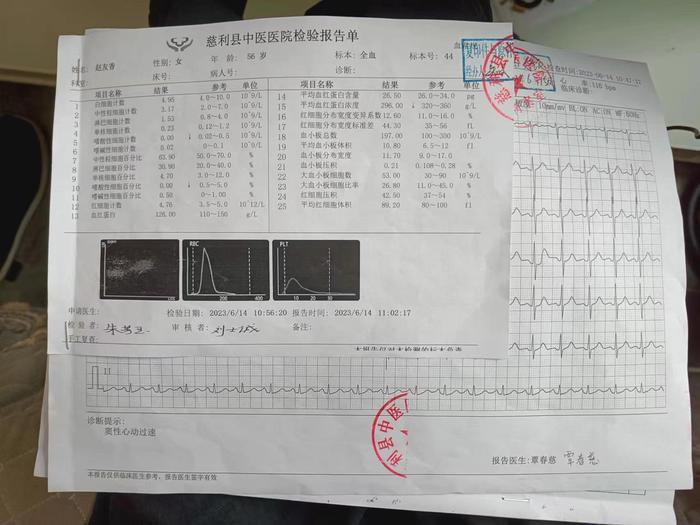 痔疮检查电子报告单子图片