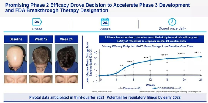 ▲Litfulo在临床试验中的疗效结果（图片来源：辉瑞官网）