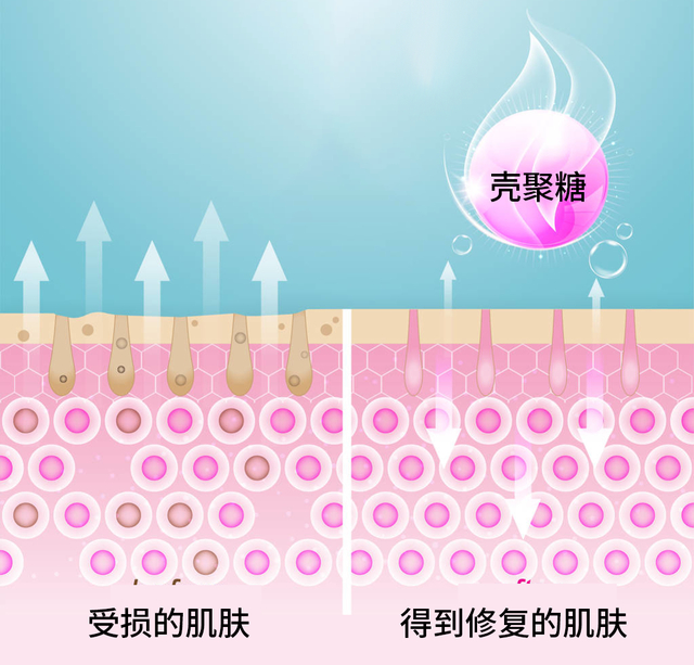 壳聚糖敷料什么时候用为什么越努力护肤,皮肤越差?罪魁祸首竟然是?_新闻资讯_第5张_活检穿刺产品网 壳聚糖敷料什么时候用为什么越努力护肤,皮肤越差?罪魁祸首竟然是?_https://www.jmylbn.com_新闻资讯_第5张