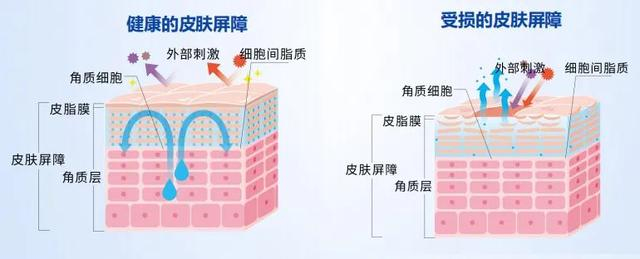 壳聚糖敷料什么时候用为什么越努力护肤，皮肤越差？罪魁祸首竟然是？_https://www.jmylbn.com_新闻资讯_第2张