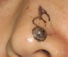 来源：丁香园论坛