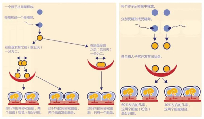 全世界仅有两例被确认,“半同卵双胞胎”是怎么回事?__财经头条