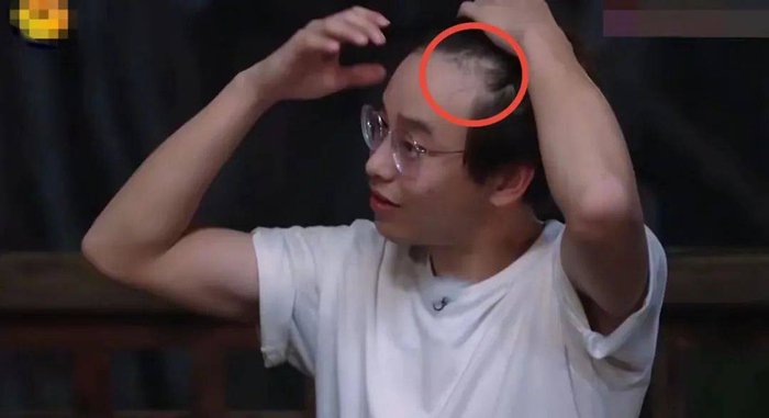 黄晓明进泳池,头发稀疏,头皮清晰可见,男明星都得靠假发片|黄晓明