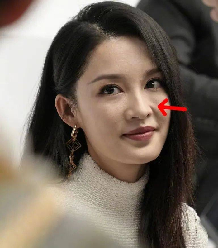 评论区很多人都在说她的皮肤状态,满脸的痘痘闭口,别说和女明星相提并